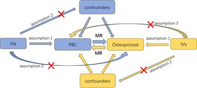 Primary biliary cirrhosis and osteoporosis: a bidirectional two-sample Mendelian randomization study